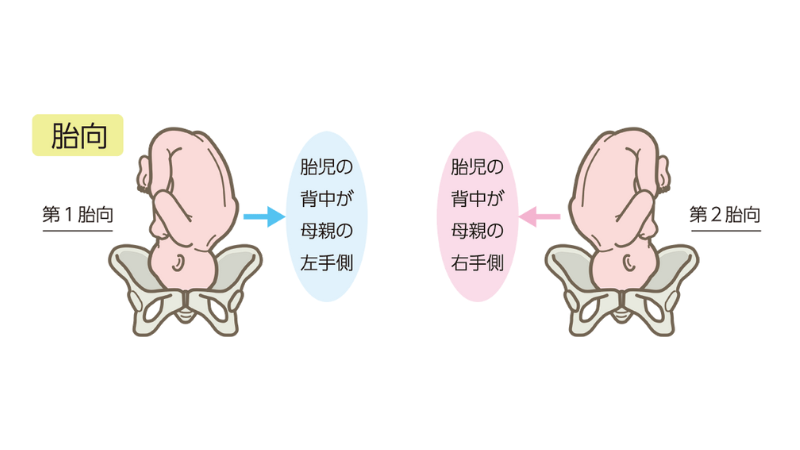 胎児胎向胎位: 胎位胎向 図 – TPWCKV